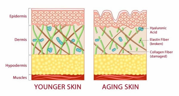 Aging Skin