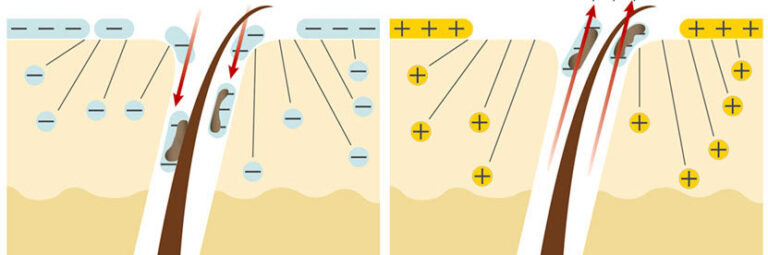 How galvanic iontophorensis treatments work