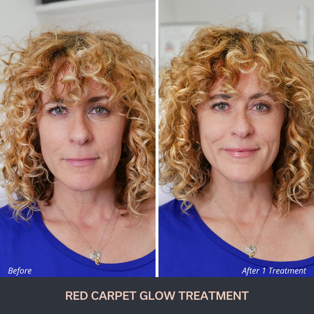 Red Carpet Facial -