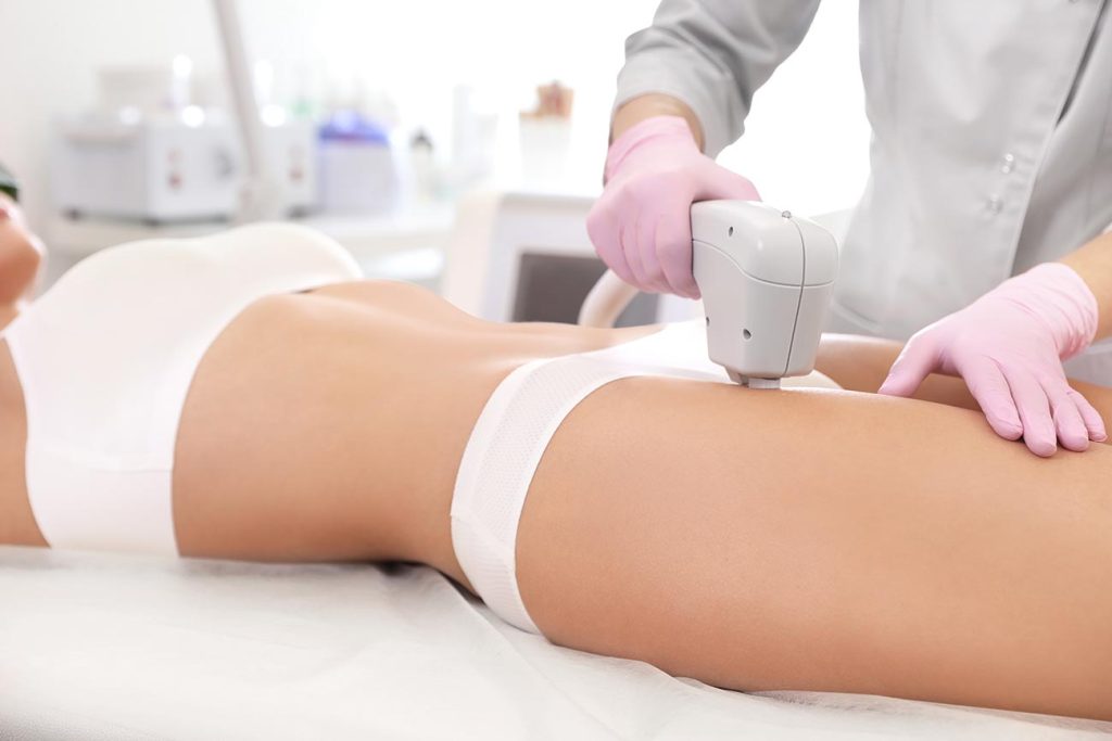 Laser hair removal las vegas