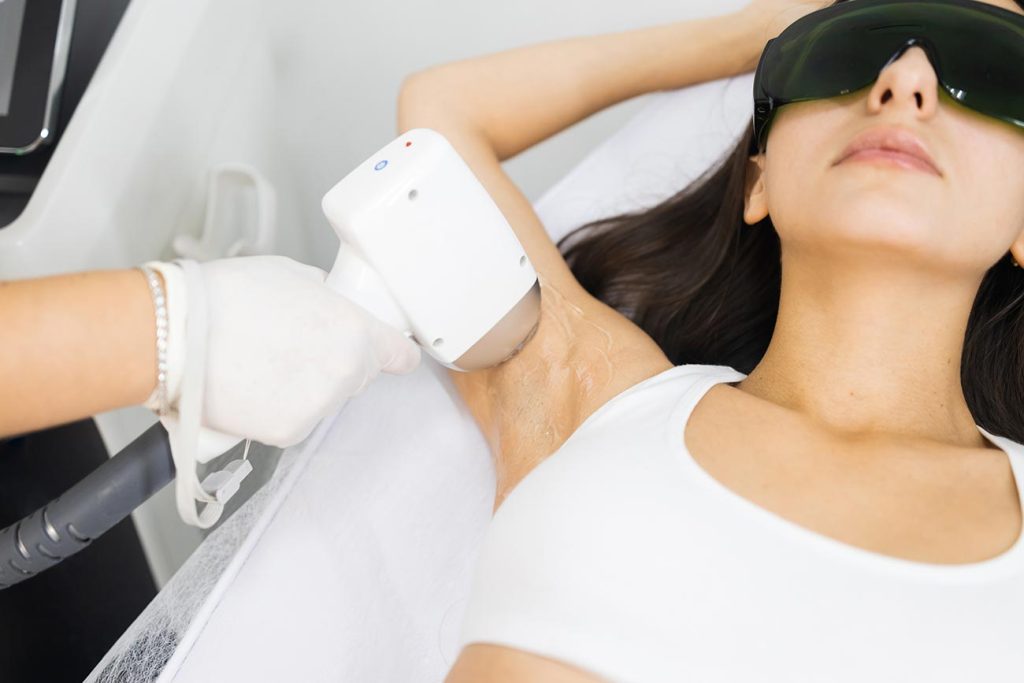 Laser hair removal USA